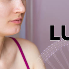 Lupus: symptoms and treatment